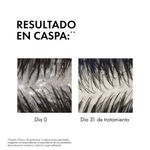 shampoo-anticaspa-para-el-cuero-cabelludo-sensible-dercos-x-200-ml