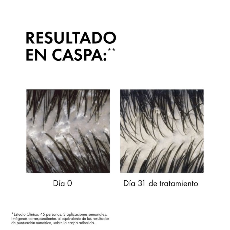 shampoo-anticaspa-para-el-cuero-cabelludo-sensible-dercos-x-200-ml