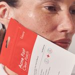 parches-coony-acne-x-24-un