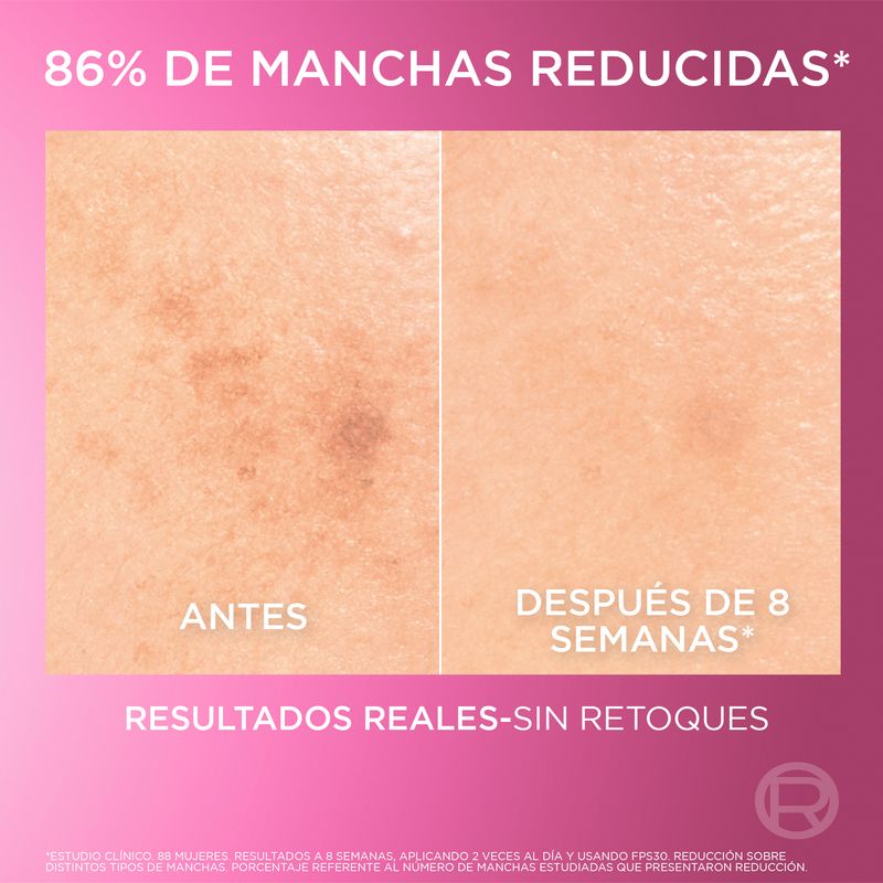 serum-anti-manchas-loreal-paris-glycolic-bright-x-30-ml