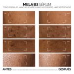 serum-la-roche-posay-mela-b3-antimanchas-niacinamida-x-30-ml