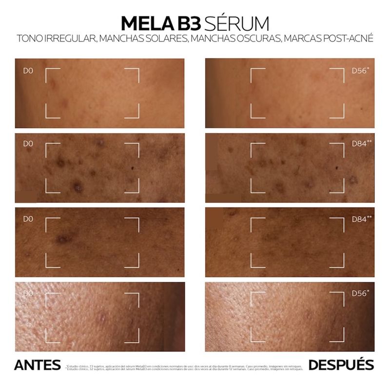 serum-la-roche-posay-mela-b3-antimanchas-niacinamida-x-30-ml